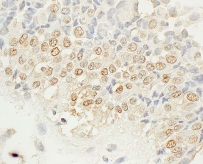 NEK4 Antibody in Immunohistochemistry (Paraffin) (IHC (P))