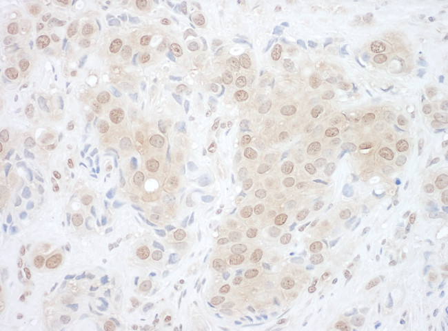 EYA2 Antibody in Immunohistochemistry (Paraffin) (IHC (P))