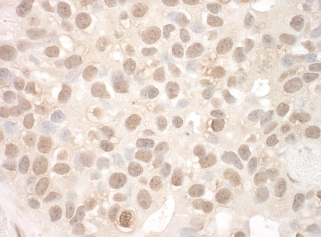 EYA2 Antibody in Immunohistochemistry (Paraffin) (IHC (P))