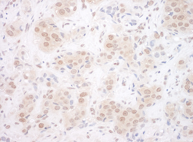 EYA3 Antibody in Immunohistochemistry (Paraffin) (IHC (P))