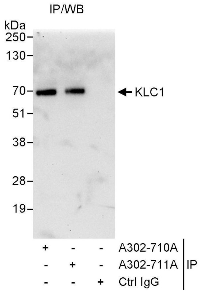 KLC1 Antibody in Immunoprecipitation (IP)