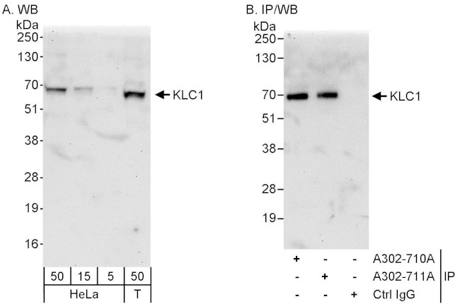 KLC1 Antibody in Western Blot (WB)