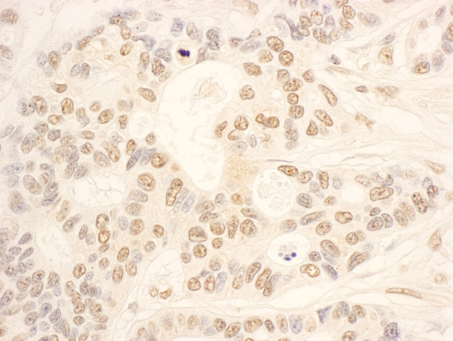 NOP58 Antibody in Immunohistochemistry (Paraffin) (IHC (P))