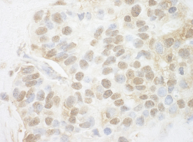 Pygo2 Antibody in Immunohistochemistry (Paraffin) (IHC (P))