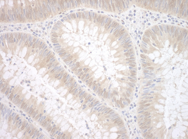 TDP2 Antibody in Immunohistochemistry (Paraffin) (IHC (P))