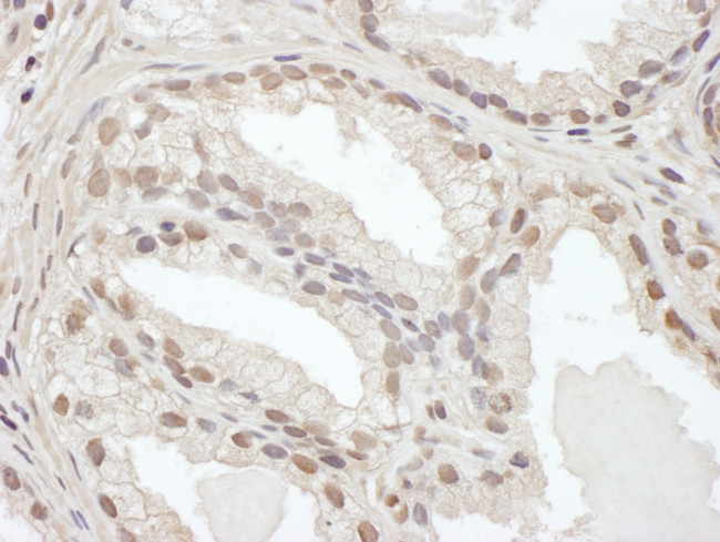 C/EBP beta Antibody in Immunohistochemistry (Paraffin) (IHC (P))