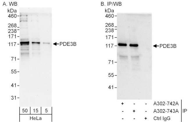 PDE3B Antibody in Western Blot (WB)