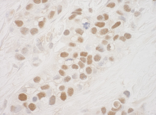 MSK1 Antibody in Immunohistochemistry (Paraffin) (IHC (P))