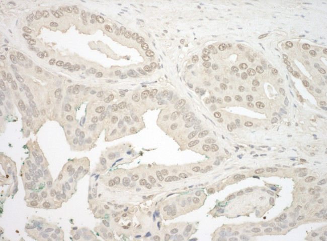 NFAT3 Antibody in Immunohistochemistry (Paraffin) (IHC (P))