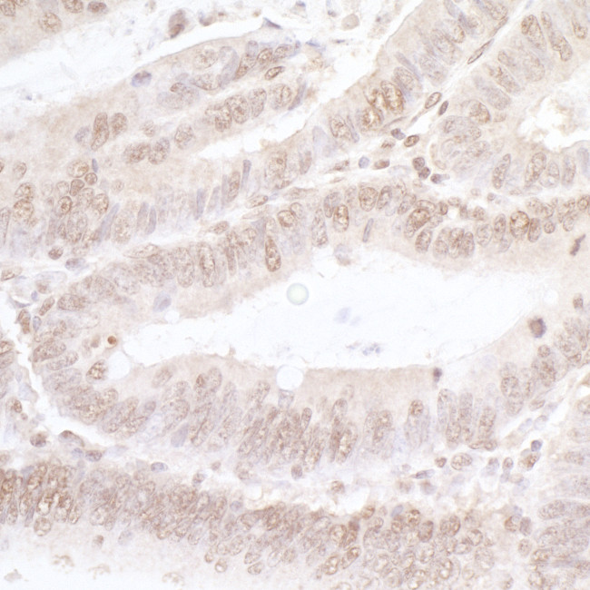 NFAT3 Antibody in Immunohistochemistry (Paraffin) (IHC (P))