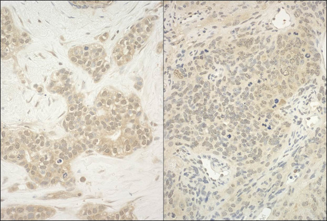 YY1 Antibody in Immunohistochemistry (Paraffin) (IHC (P))