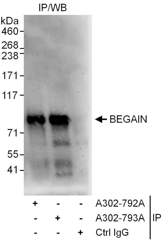 BEGAIN Antibody in Immunoprecipitation (IP)