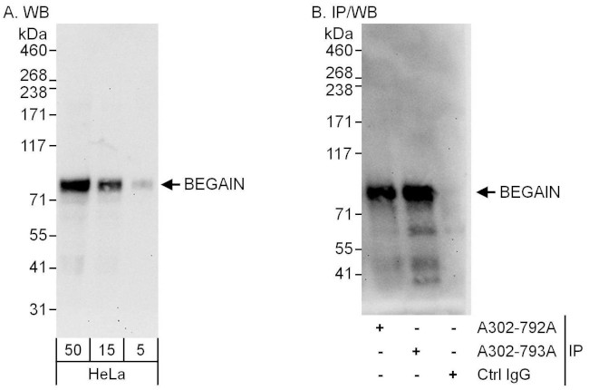 BEGAIN Antibody in Western Blot (WB)