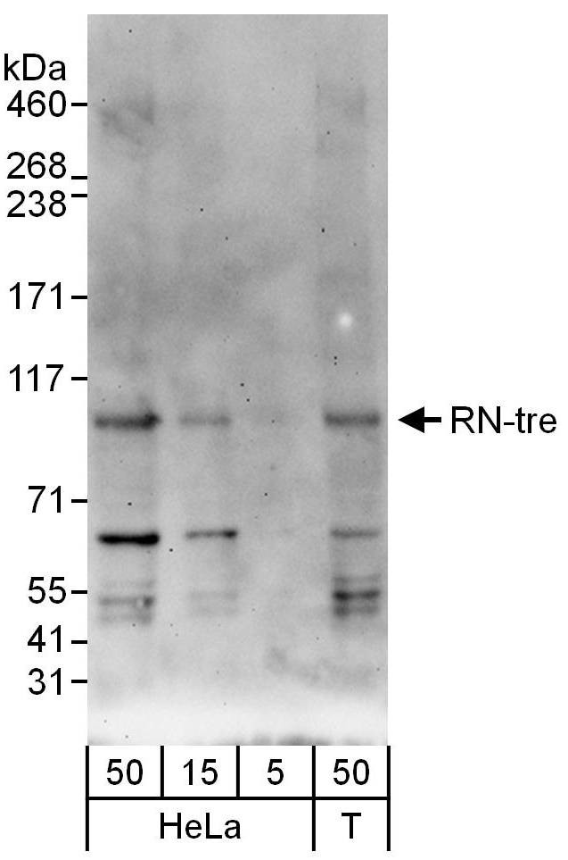 RN-tre Antibody in Western Blot (WB)