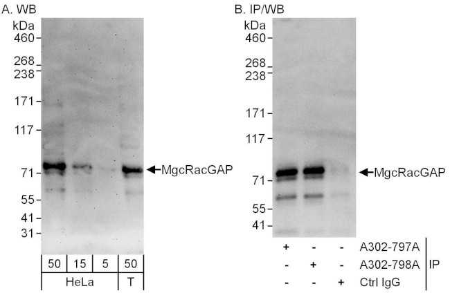 MgcRacGAP Antibody in Western Blot (WB)