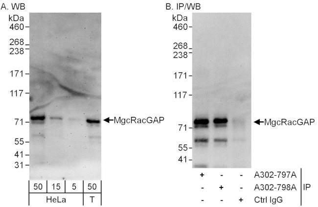 MgcRacGAP Antibody in Western Blot (WB)