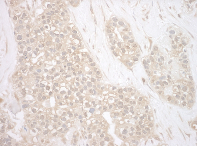 BAG3 Antibody in Immunohistochemistry (Paraffin) (IHC (P))