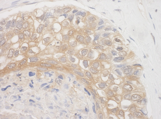 BAG3 Antibody in Immunohistochemistry (Paraffin) (IHC (P))