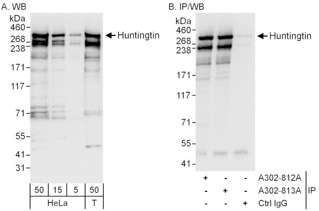 Huntingtin Antibody in Western Blot (WB)