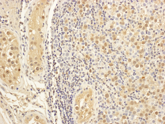 MAP1S Antibody in Immunohistochemistry (Paraffin) (IHC (P))