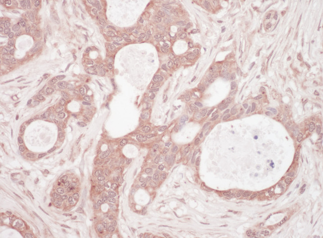 Sequestosome-1 Antibody in Immunohistochemistry (Paraffin) (IHC (P))