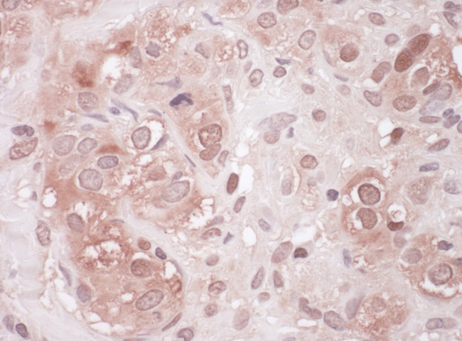 Sequestosome-1 Antibody in Immunohistochemistry (Paraffin) (IHC (P))