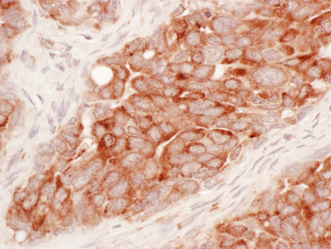 Reticulon-3 Antibody in Immunohistochemistry (Paraffin) (IHC (P))