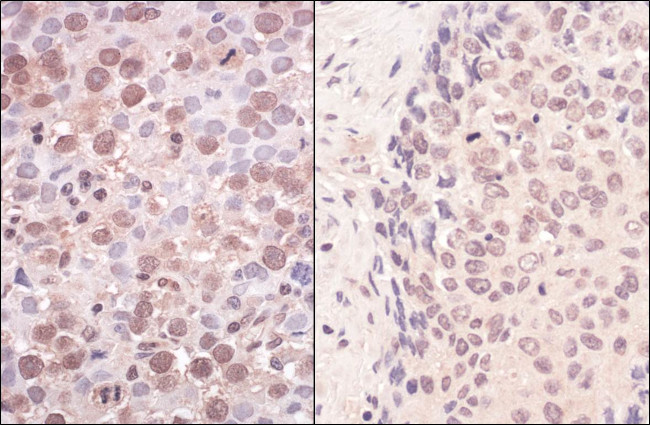 SmcHD1 Antibody in Immunohistochemistry (Paraffin) (IHC (P))