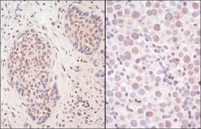 SmcHD1 Antibody in Immunohistochemistry (Paraffin) (IHC (P))