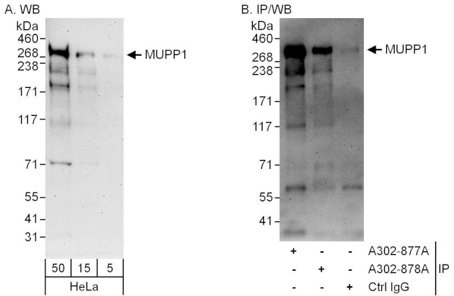 MUPP1 Antibody in Western Blot (WB)