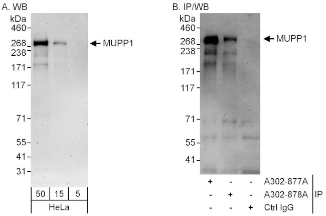 MUPP1 Antibody in Western Blot (WB)