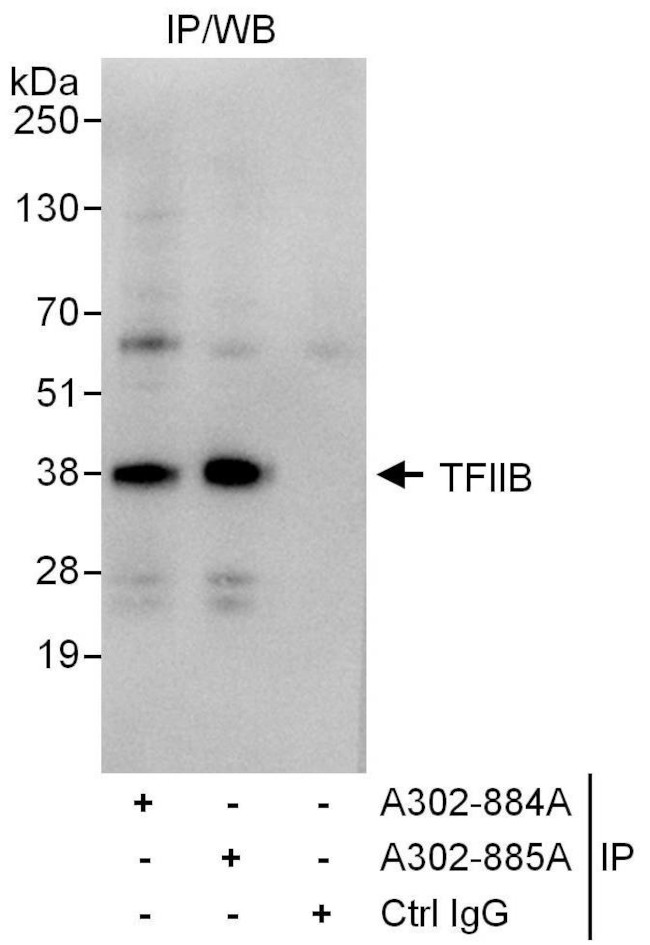 GTF2B/TFIIB Antibody in Immunoprecipitation (IP)