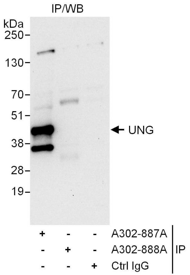 UNG Antibody in Immunoprecipitation (IP)