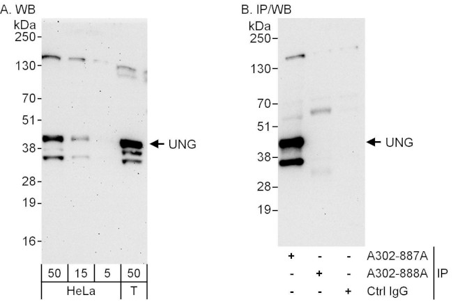 UNG Antibody in Western Blot (WB)