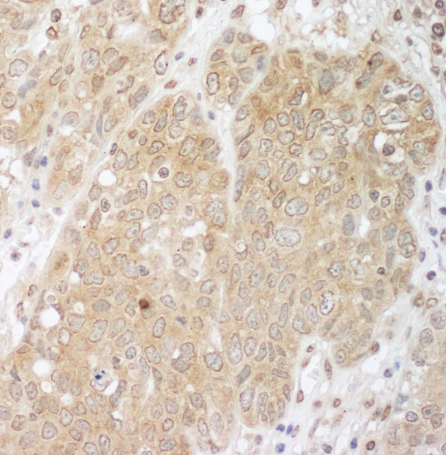 Cbl-b Antibody in Immunohistochemistry (Paraffin) (IHC (P))