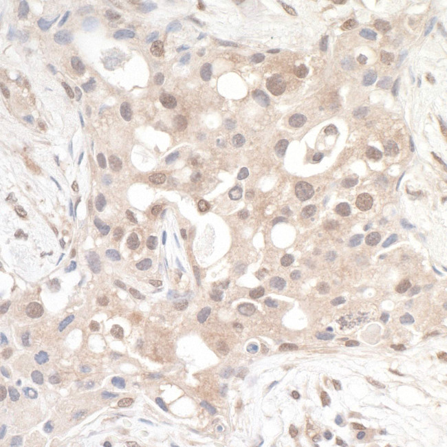 RABGEF1 Antibody in Immunohistochemistry (Paraffin) (IHC (P))