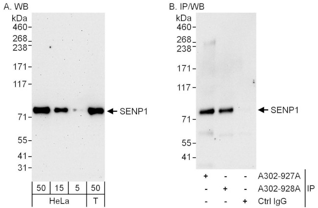 SENP1 Antibody in Western Blot (WB)