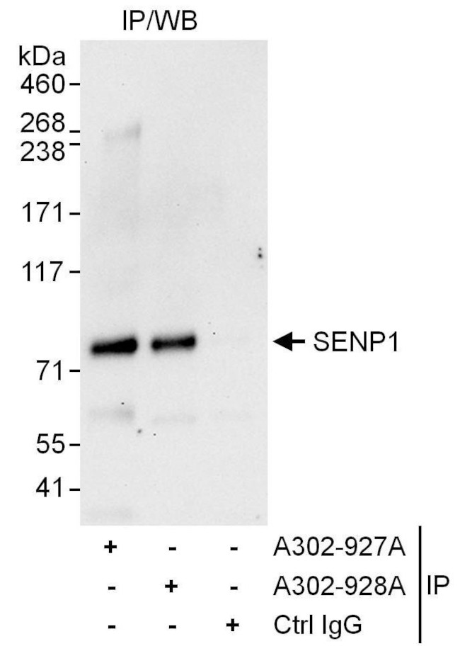 SENP1 Antibody in Immunoprecipitation (IP)