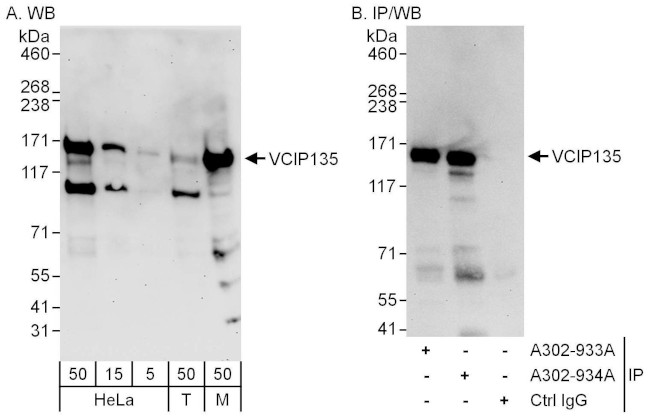 VCIP135 Antibody in Western Blot (WB)