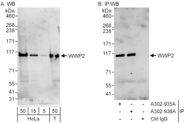 WWP2 Antibody in Western Blot (WB)