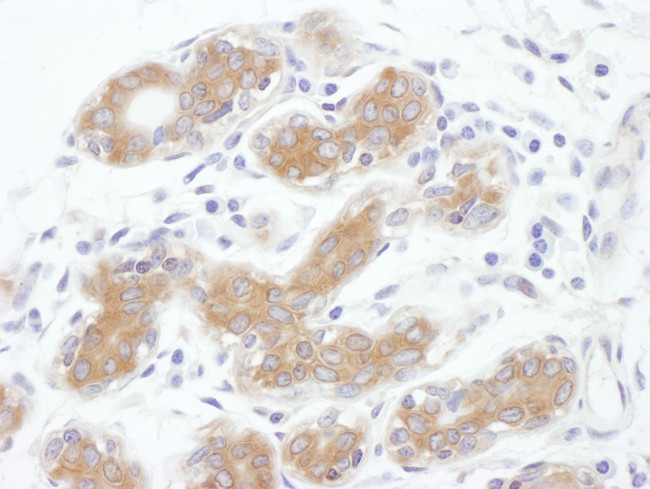 ALIX Antibody in Immunohistochemistry (Paraffin) (IHC (P))