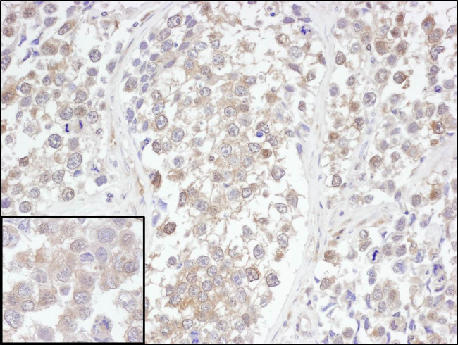 UCH-L3 Antibody in Immunohistochemistry (Paraffin) (IHC (P))