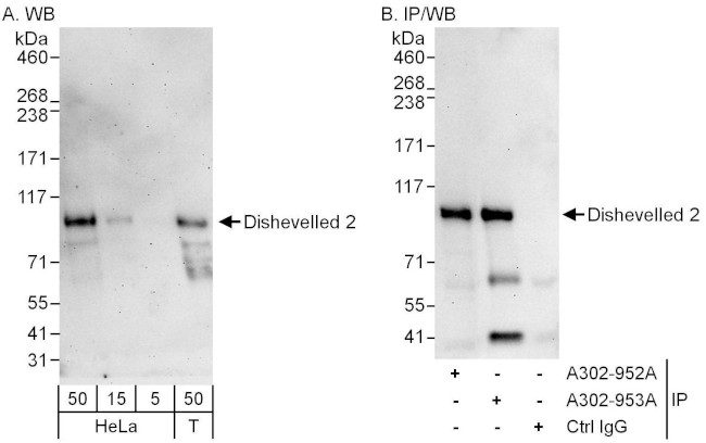 Dishevelled 2 Antibody in Western Blot (WB)