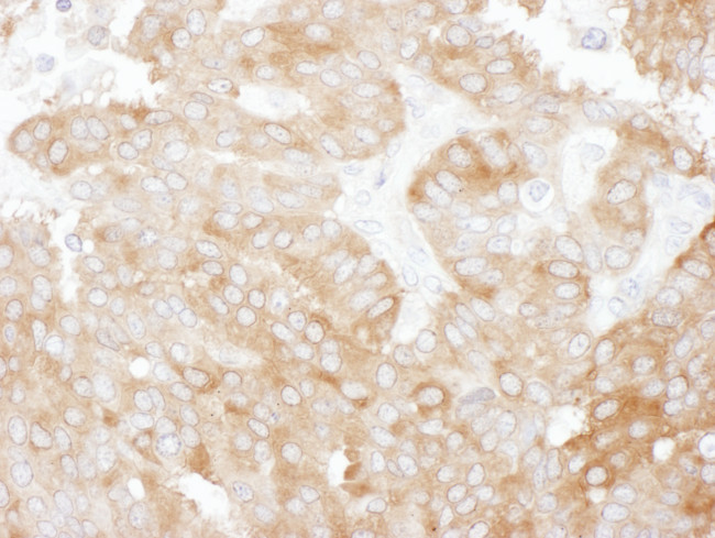 NHERF1 Antibody in Immunohistochemistry (Paraffin) (IHC (P))