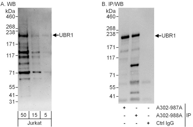 UBR1 Antibody in Western Blot (WB)