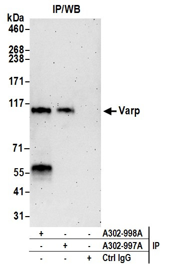 Varp Antibody in Immunoprecipitation (IP)