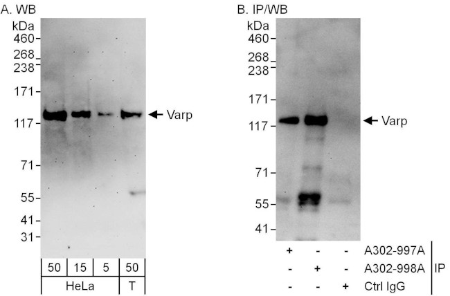 Varp Antibody in Western Blot (WB)