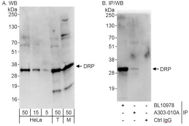 DRP Antibody in Western Blot (WB)