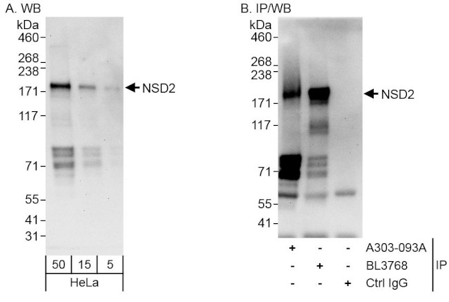 NSD2 Antibody in Western Blot (WB)