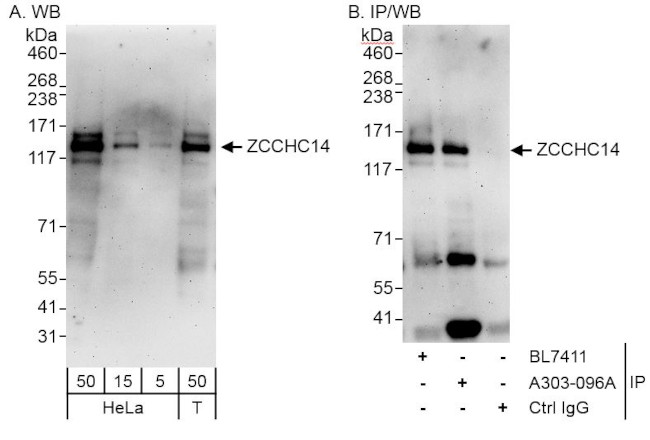 ZCCHC14 Antibody in Western Blot (WB)